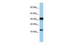 H2AFJ Rabbit anti-Human, Polyclonal, Novus Biologicals 100 &mu;g | Buy Online | Novus Biologicals | Fisher Scientific